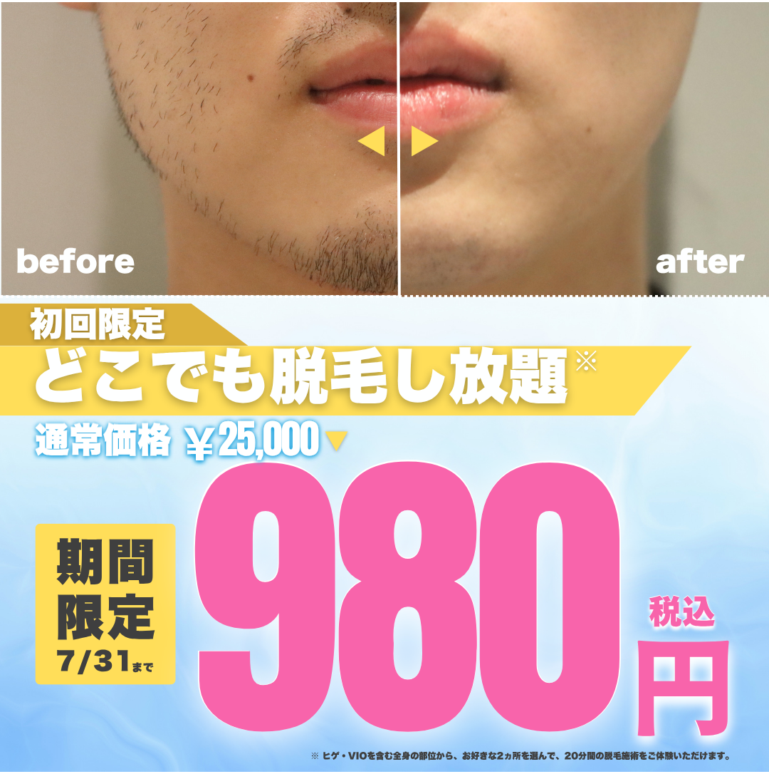 ＼【夏本番】肌見せの季節、ムダ毛ケアはお済みですか？／メンズ脱毛サロン「メンズクリア」初回体験980円！