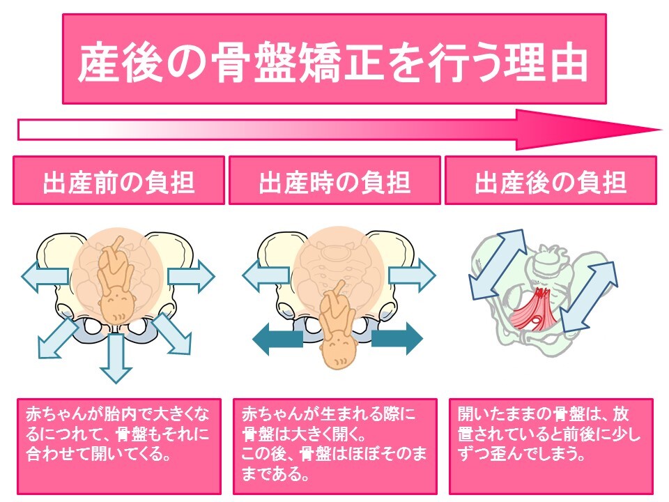 骨盤の歪み放置していませんか？
