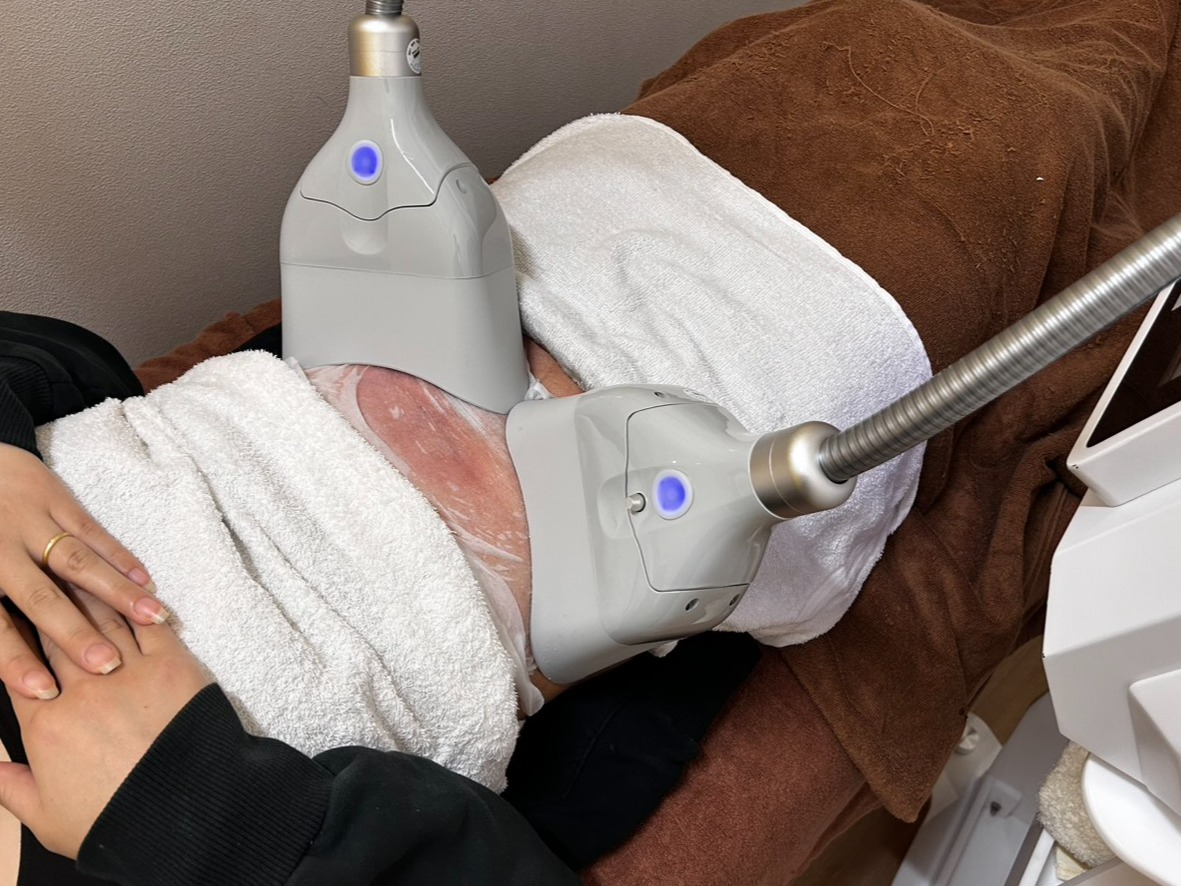 痩身メニュー　脂肪冷却！