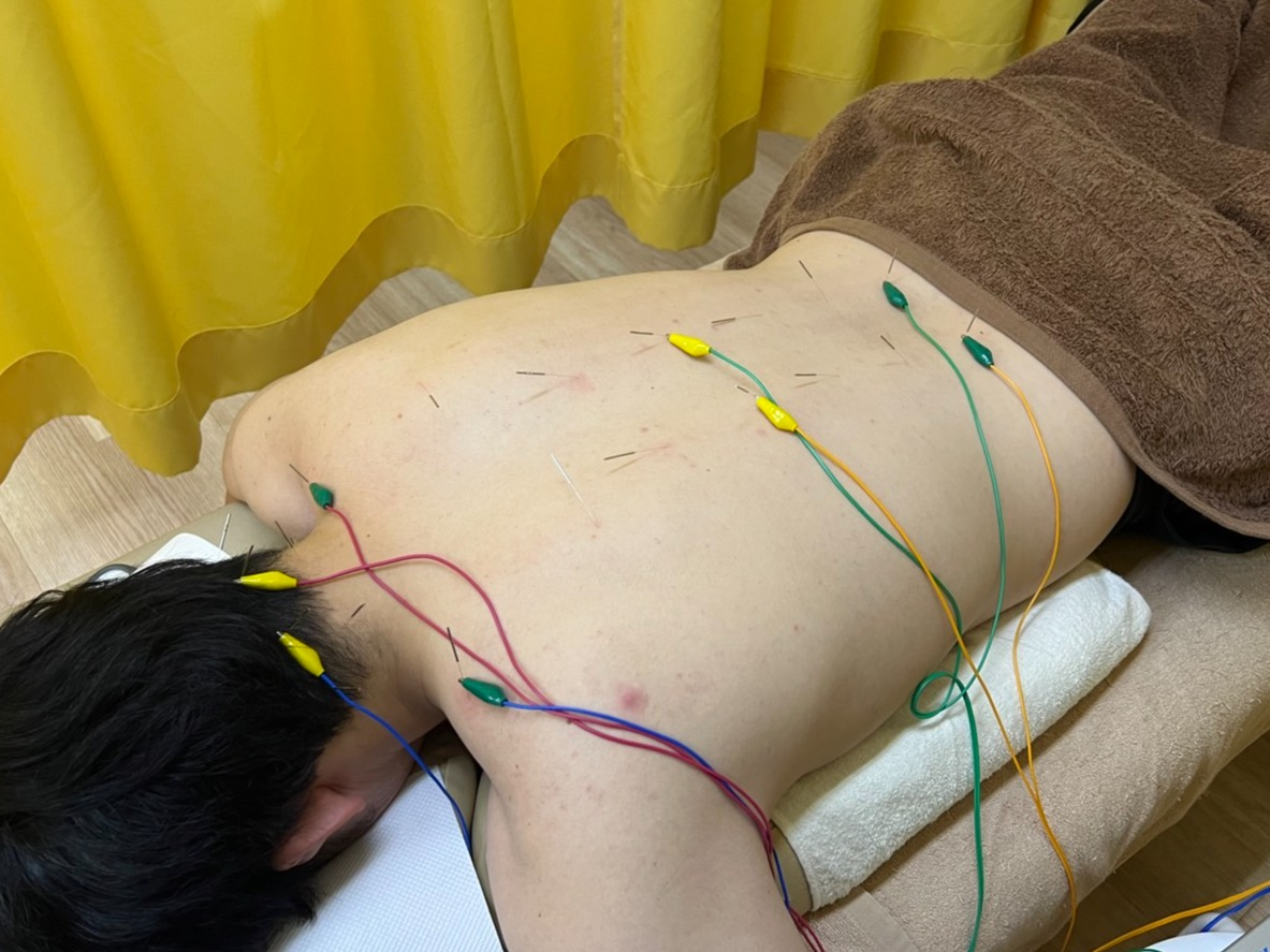 ギックリ腰、最近増加しております！！