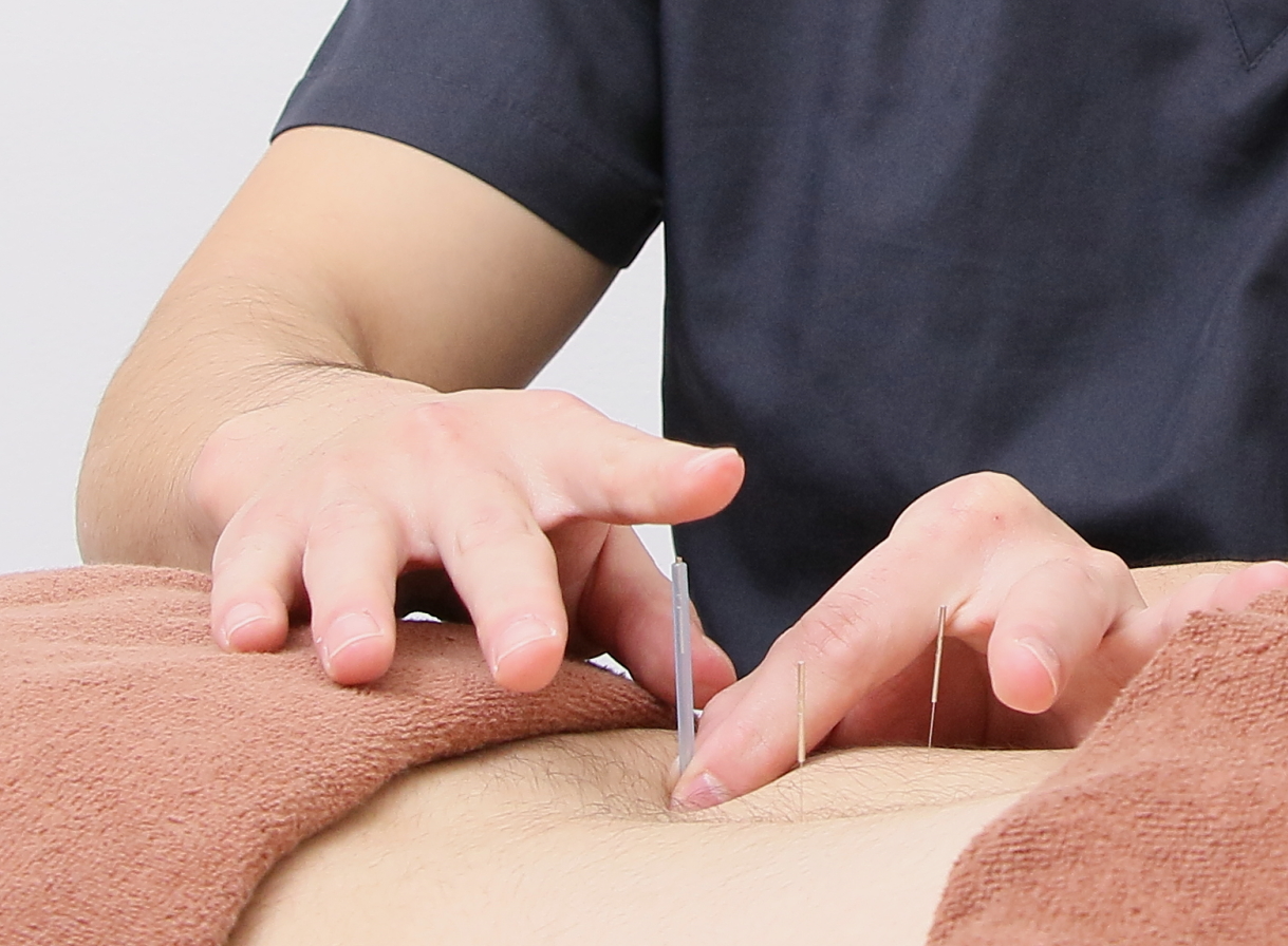 金～日曜限定　鍼治療・美容鍼