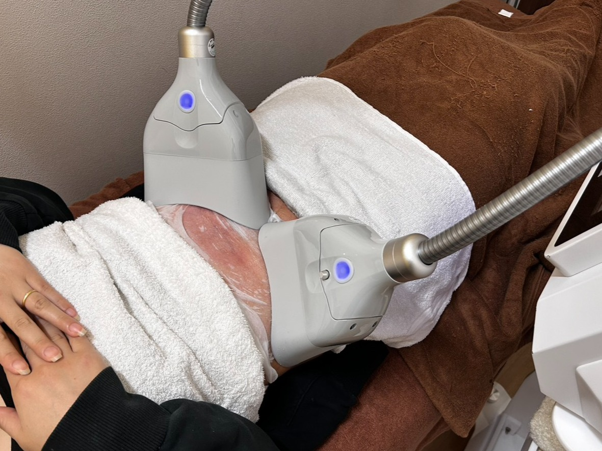 脂肪冷却で身体のラインがスッキリ！