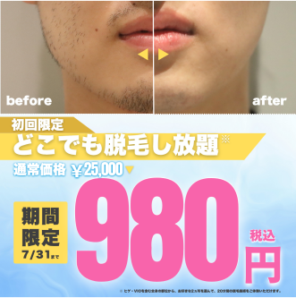 ＼【夏本番】肌見せの季節、ムダ毛ケアはお済みですか？／メンズ脱毛サロン「メンズクリア」初回体験980円！