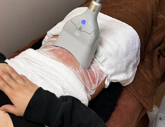 脂肪冷却やってみませんか？